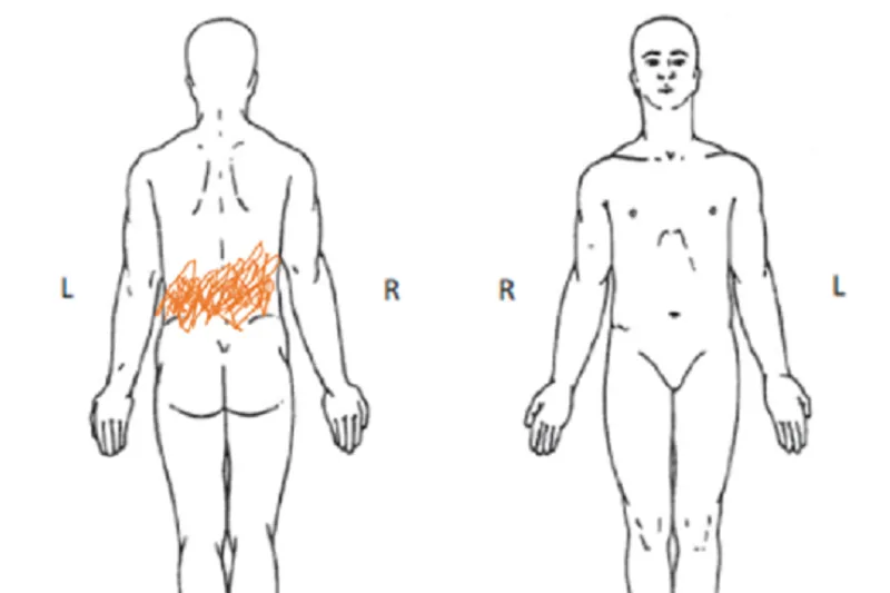 A689 idiopatisk