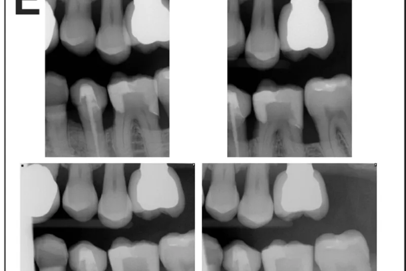 a655 fig.