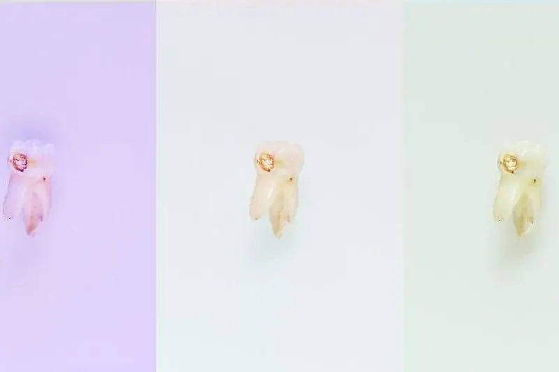 Caries mælketænder