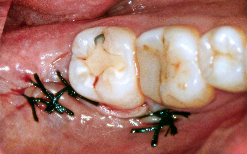 TB2025 10 Lær Af Fejlen