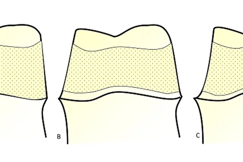 a636 fig.