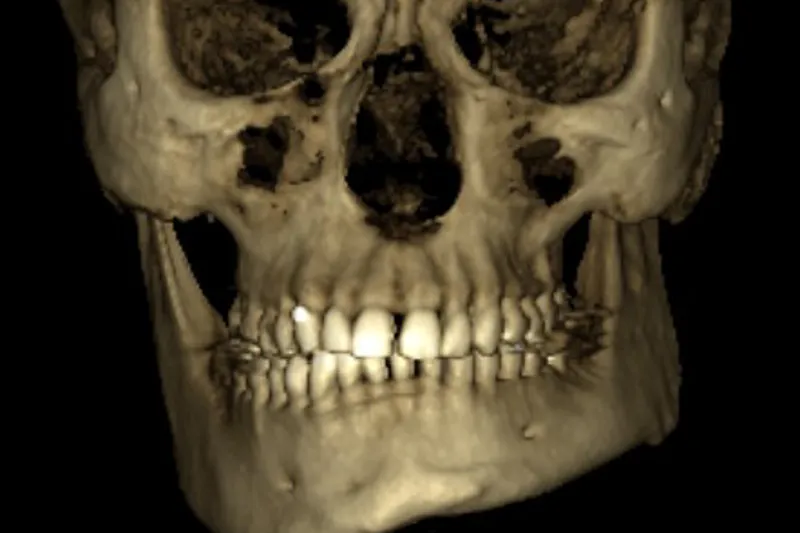 a651 fig.