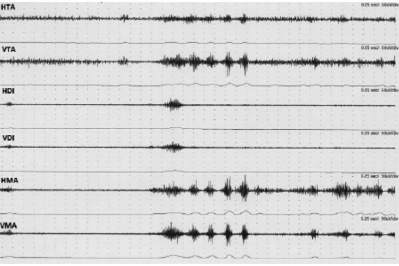 a671 fig.