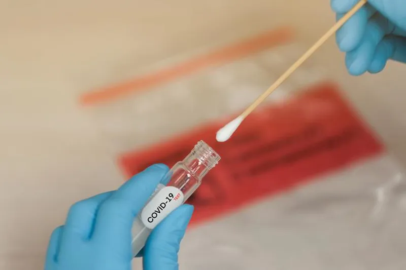 covid-19 test