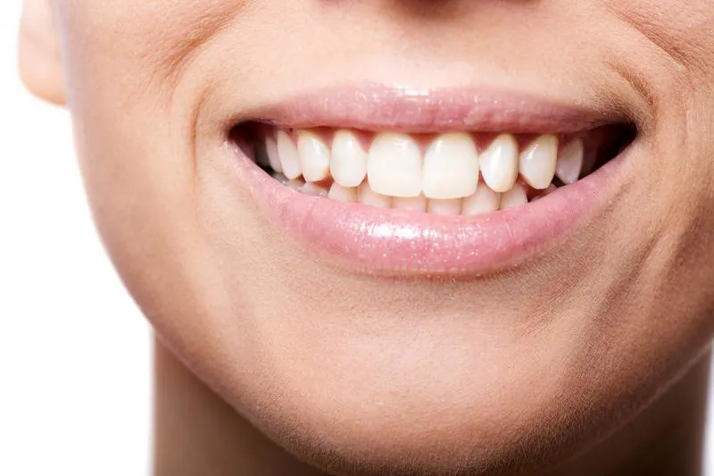 Smil