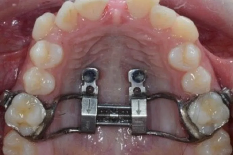 a638 fig.