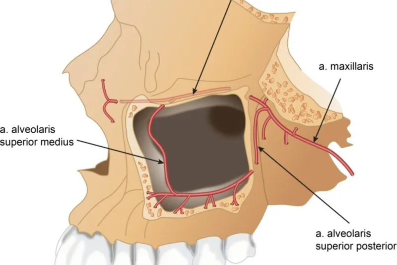 a658 fig. 1