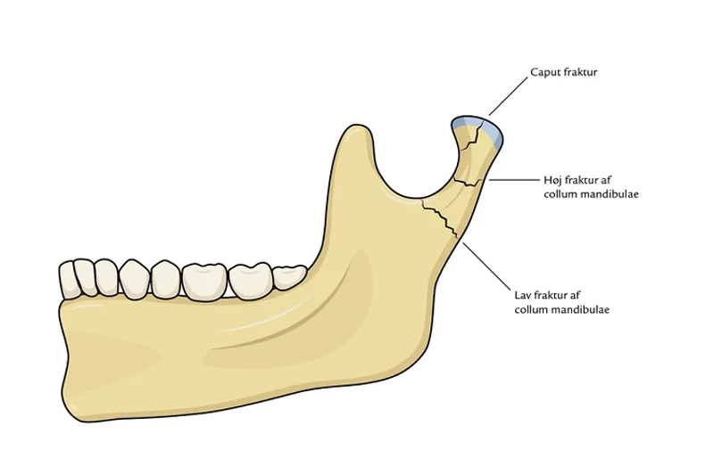a664 fig. 1