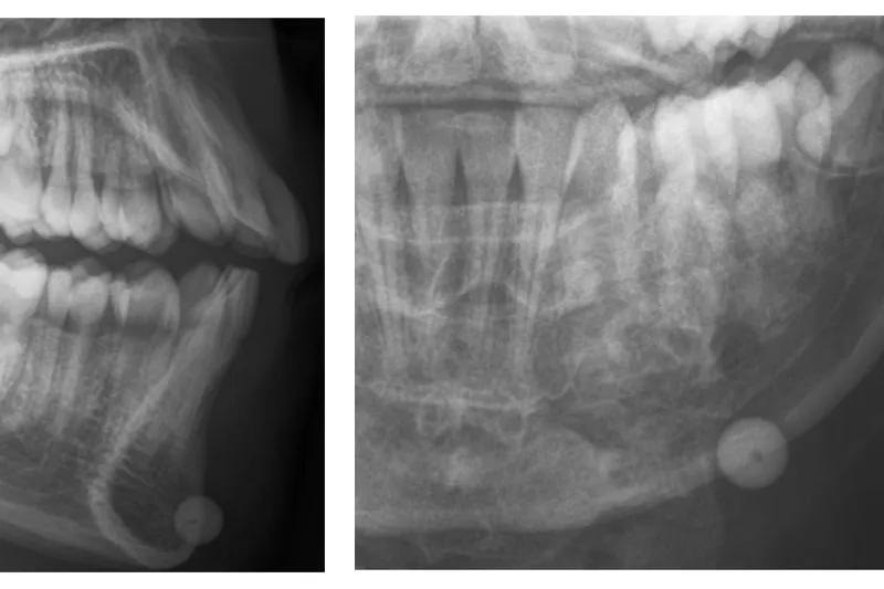 Fig3ab A362 0
