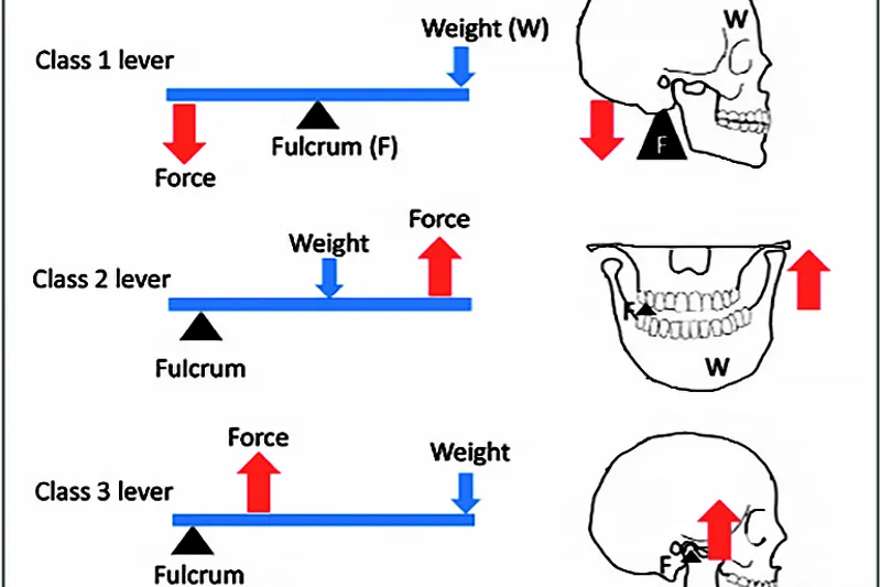 A742 Okklusion og TMD (1)