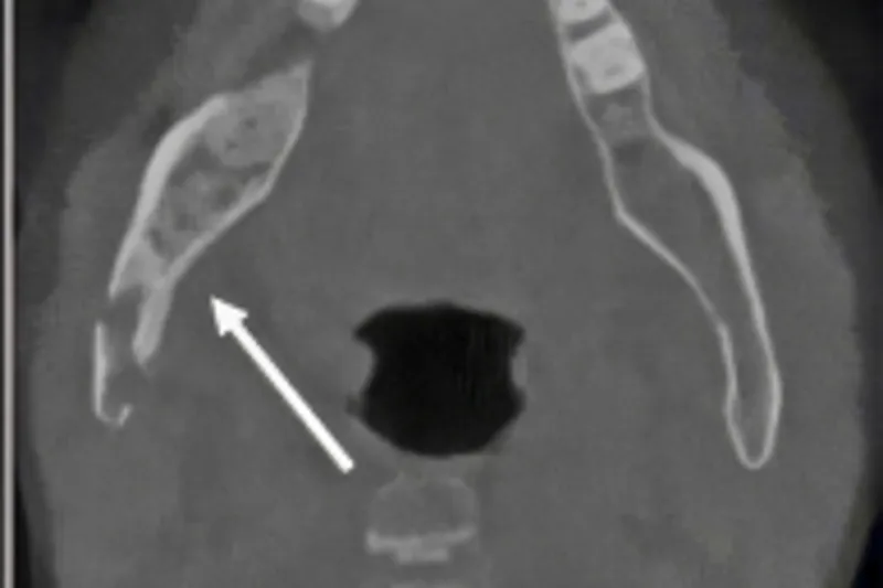 Fig 1B