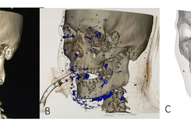 a665 fig. 1