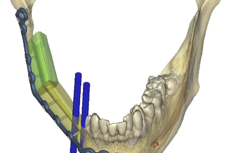 a642 fig. 5
