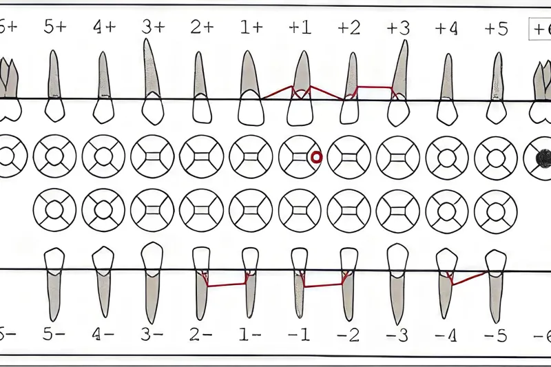 A774 Retsodontologisk personidentifikation