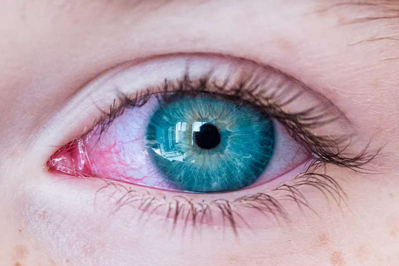 TB2024 04 Lær Af Fejlen Fluorid