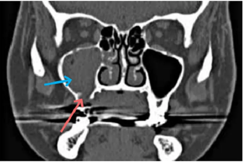 a641 fig.