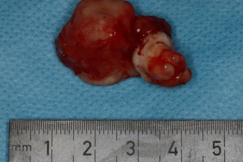 a628 odontom